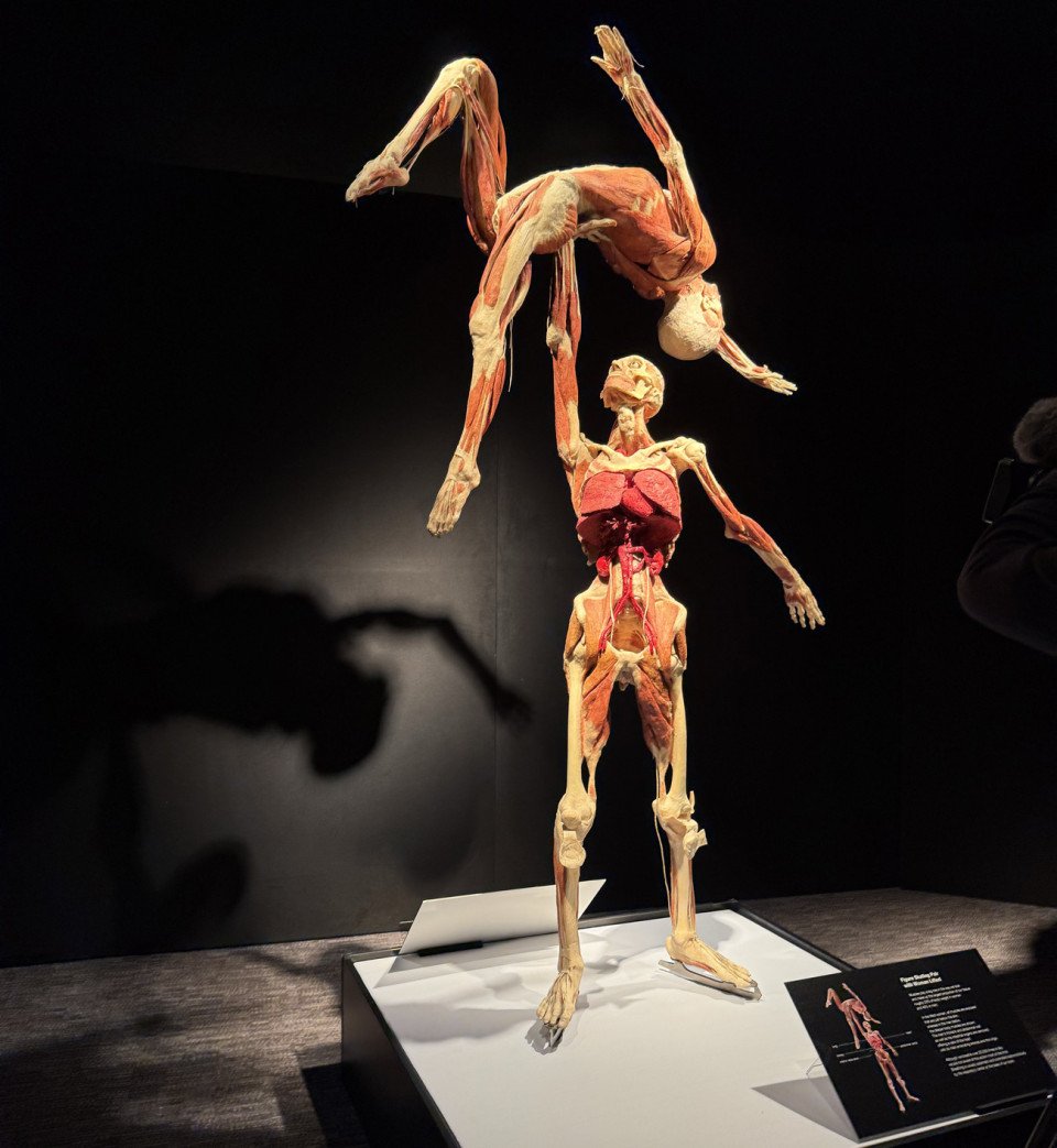 franklin institute body worlds exhibit